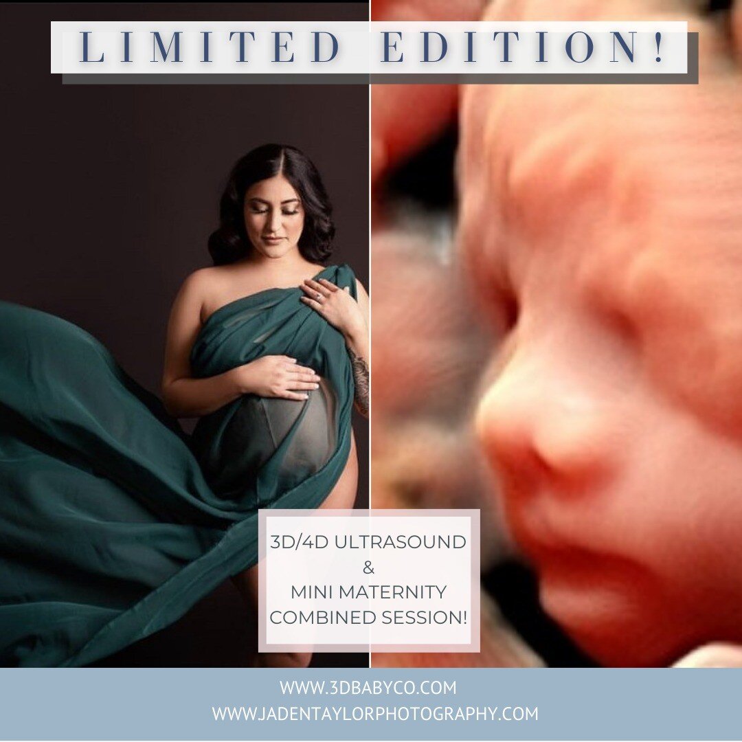✨The 3D Baby Co and @jadentaylorphotography are partnering up!✨

On Feb 26, I will be joining Jaden in her studio! We will be offering a bundled 2-for-1 pregnancy package... get BOTH a mini maternity photo shoot AND a mini 3D/4D ultrasound ALL done d