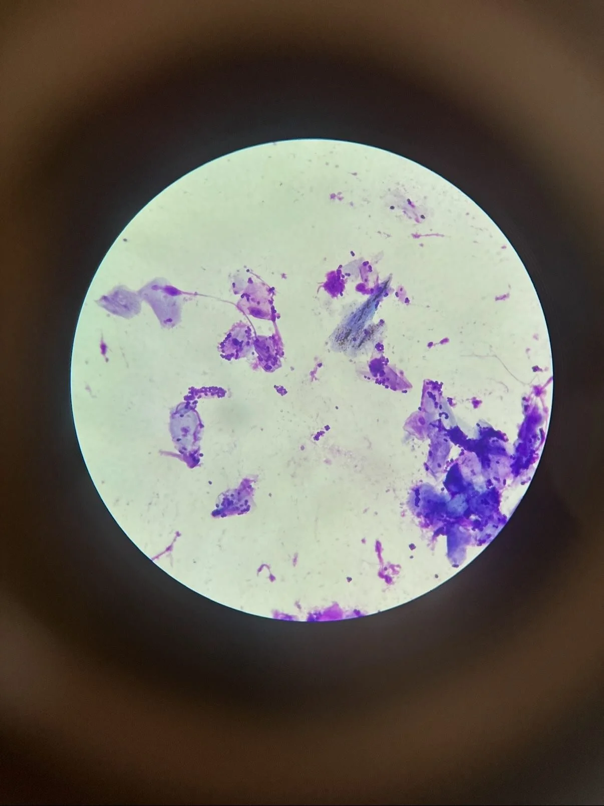 It&rsquo;s that time of year again 🤧🍃🌦️

Spring in Oklahoma means allergy season is here 🌼

Did you know allergies in dogs can show up as ear infections? That&rsquo;s why we perform ear cytologies&mdash;to look at what&rsquo;s causing the infecti