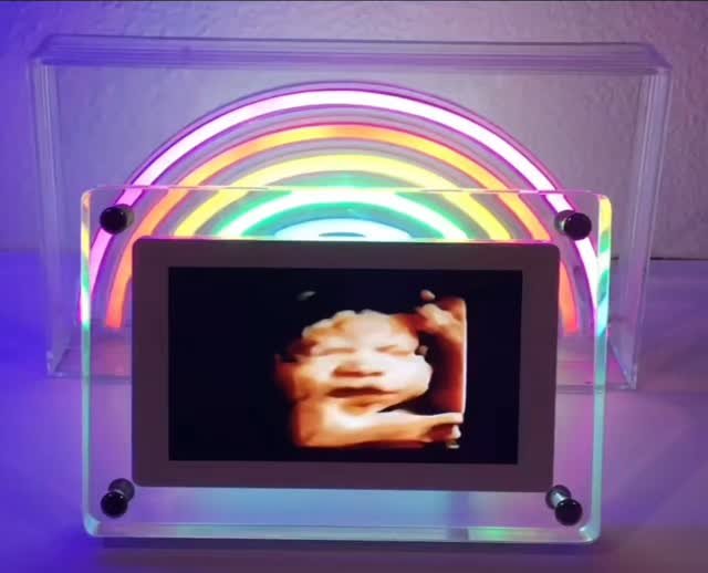 Surprise a loved one with our stylish digital video frame that lets you replay ultrasounds at home! ๐ผ๏ธโจ This rechargeable 4GB frame easily uploads ultrasound videos or photos, creating a delightful looping playback. ๐ธ๐
With an adaptable display f