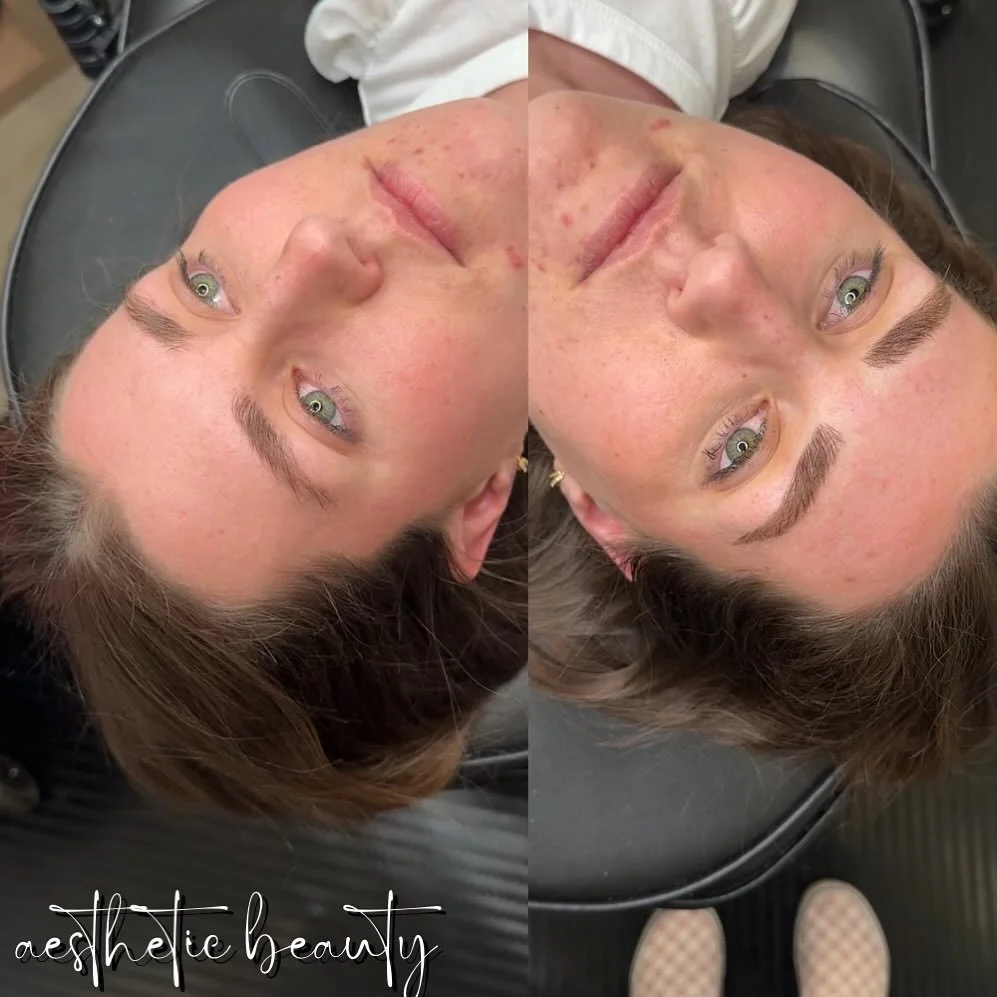 Microblade + Shading. Her brows but.. BETTER🙌🏽 I love comparing the before and after pictures, and what it does to their face. The end results were perfect! 

&bull;
&bull;
&bull;
&bull;

#beforeandafter #microblading #pmuartist #cedarcitybrows #co