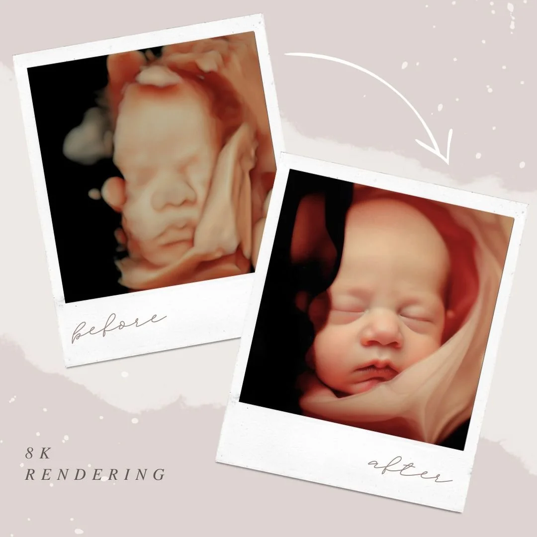 8K enhanced ultrasound photo example