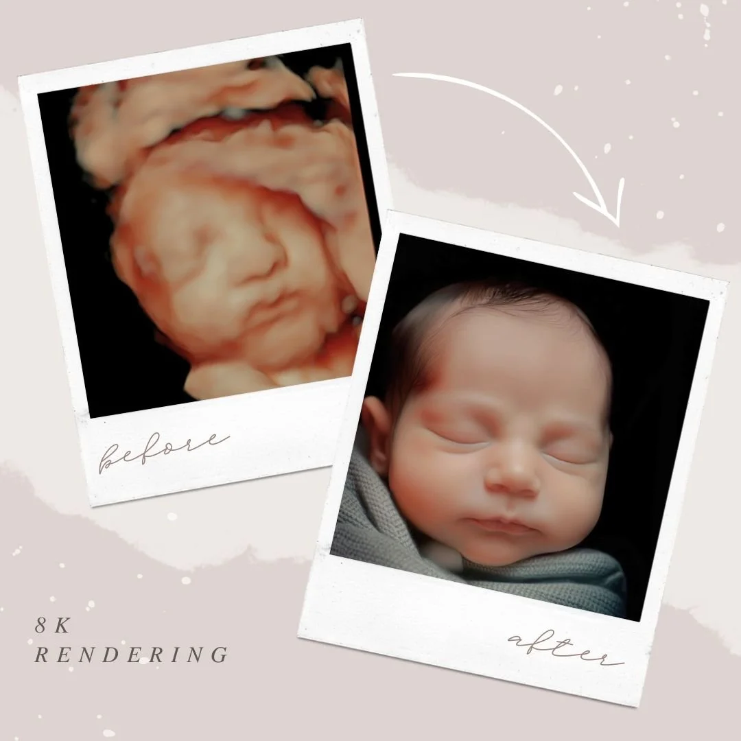 Ultrasound image enhanced to 8K keepsake photo