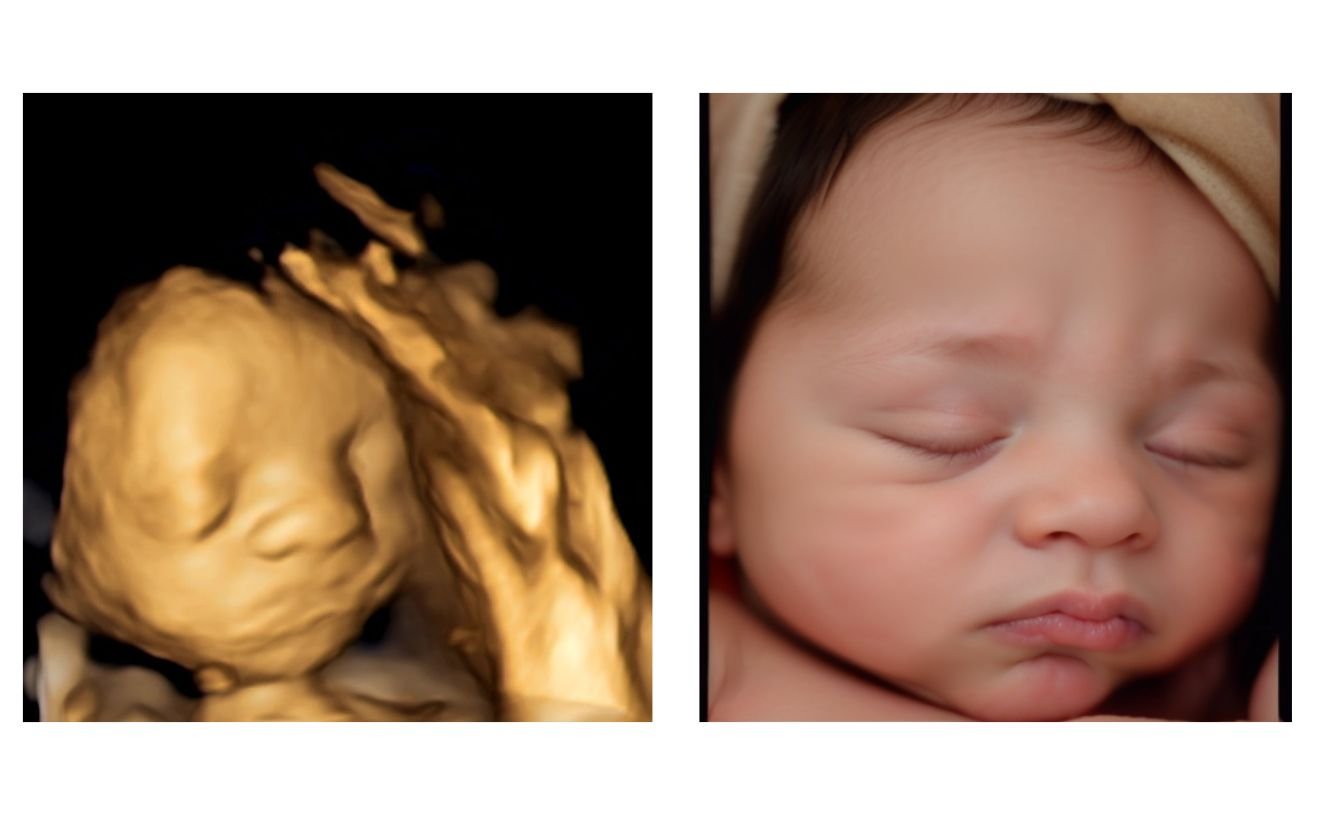 8K Digital Ultrasound Enhancements