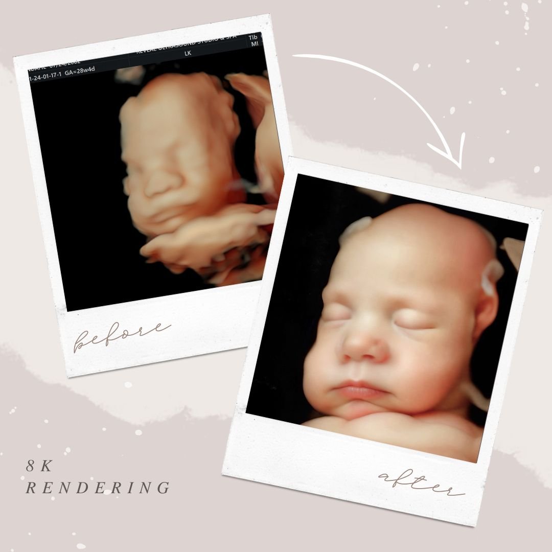 Before and after 8K ultrasound photo enhancement