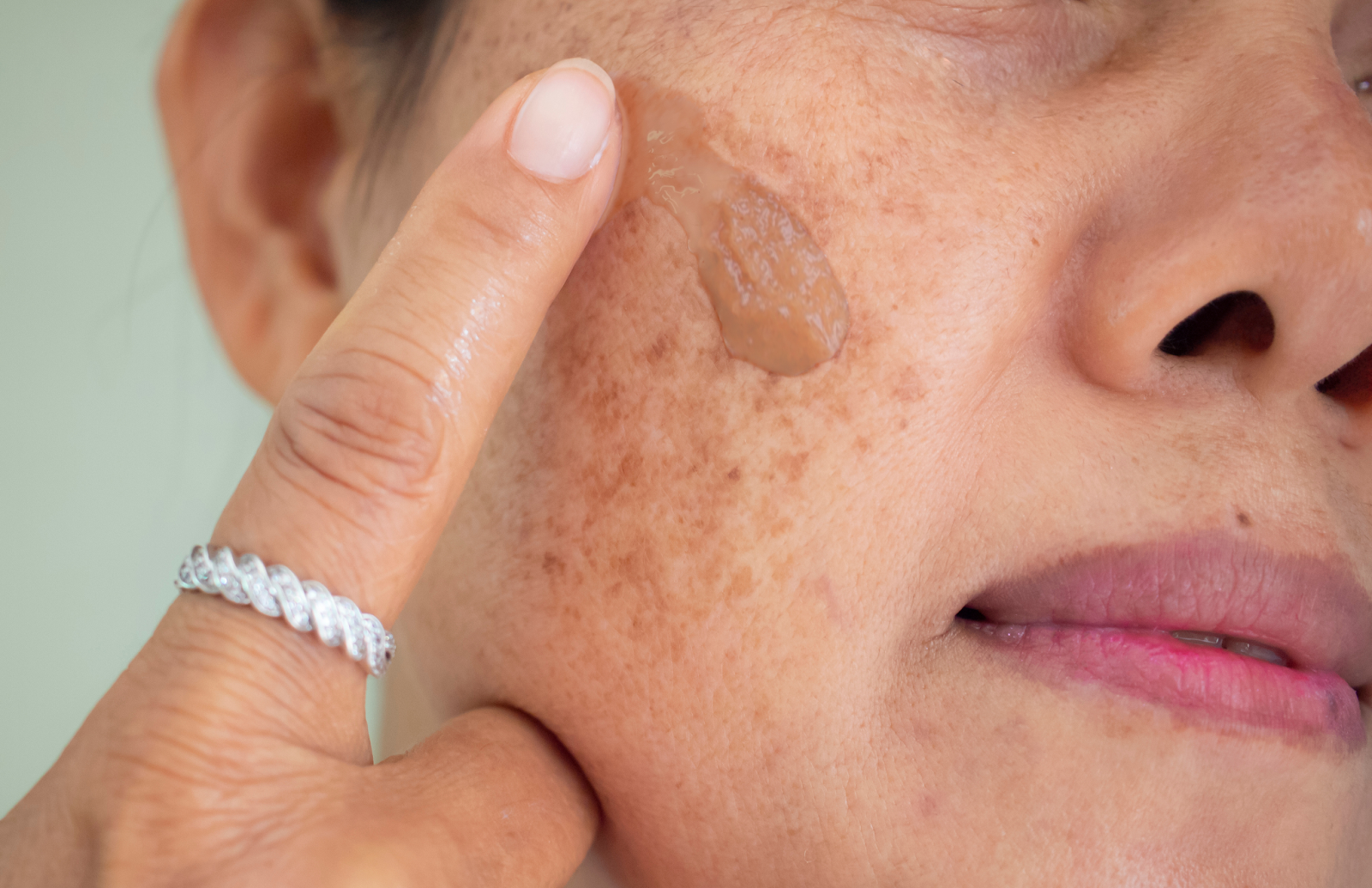 Why am I getting Dark Spots on my face? — GMARO Magazine