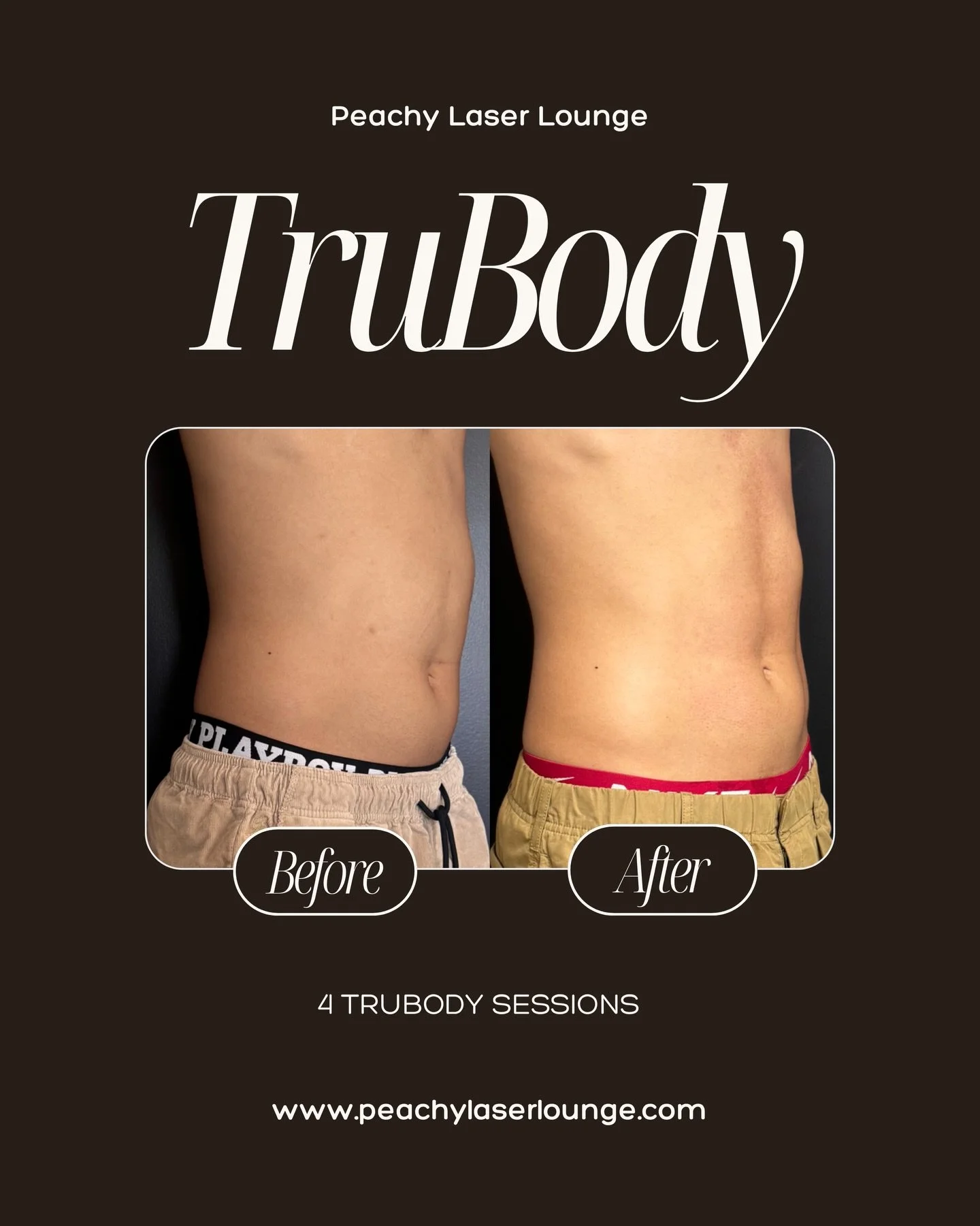 Real results, real confidence 💪🏼 
This before &amp; after shows the power of TruBody, designed to help tone, tighten, and strengthen without surgery or downtime 🔥 

TruBody uses advanced technology to target stubborn areas, improve muscle definiti