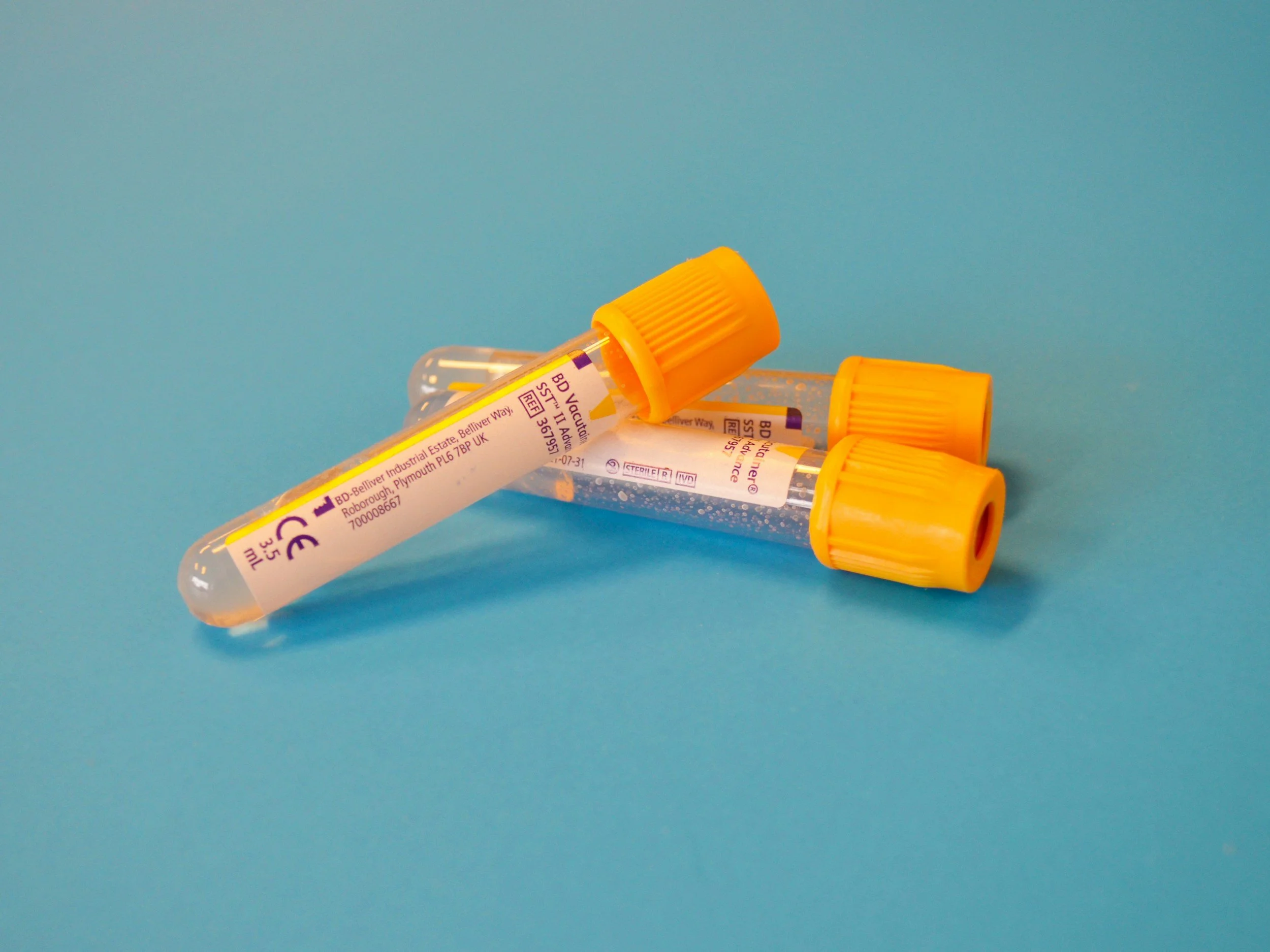 Blood sample vials used for laboratory testing to assess immune system health.