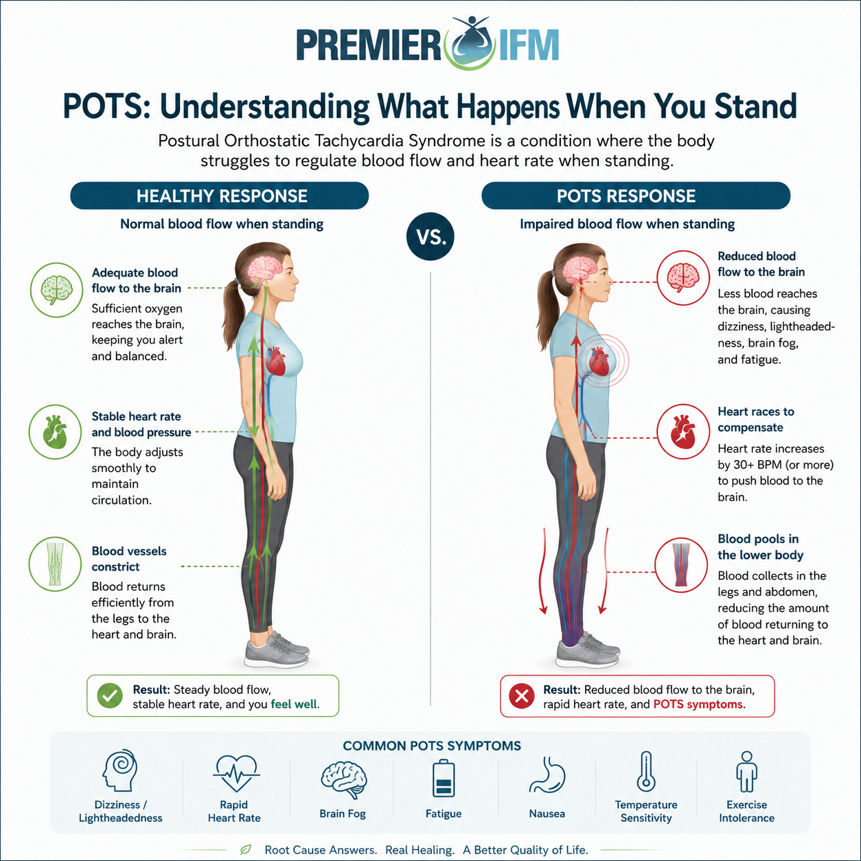 POTS blood flow diagram showing reduced brain circulation and blood pooling when standing compared to a healthy response by Premier IFM in Placentia California