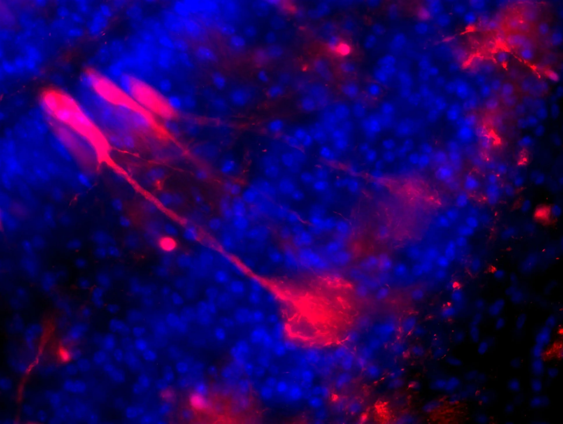 2ul_batch 11_tdtomato facial vein img3_c1-2.jpg