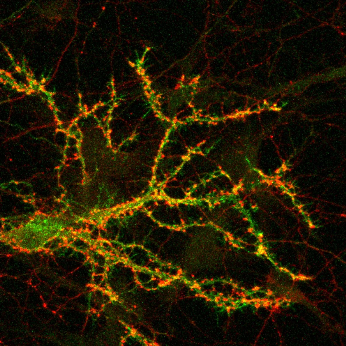 Slitrk1 confocal.jpg
