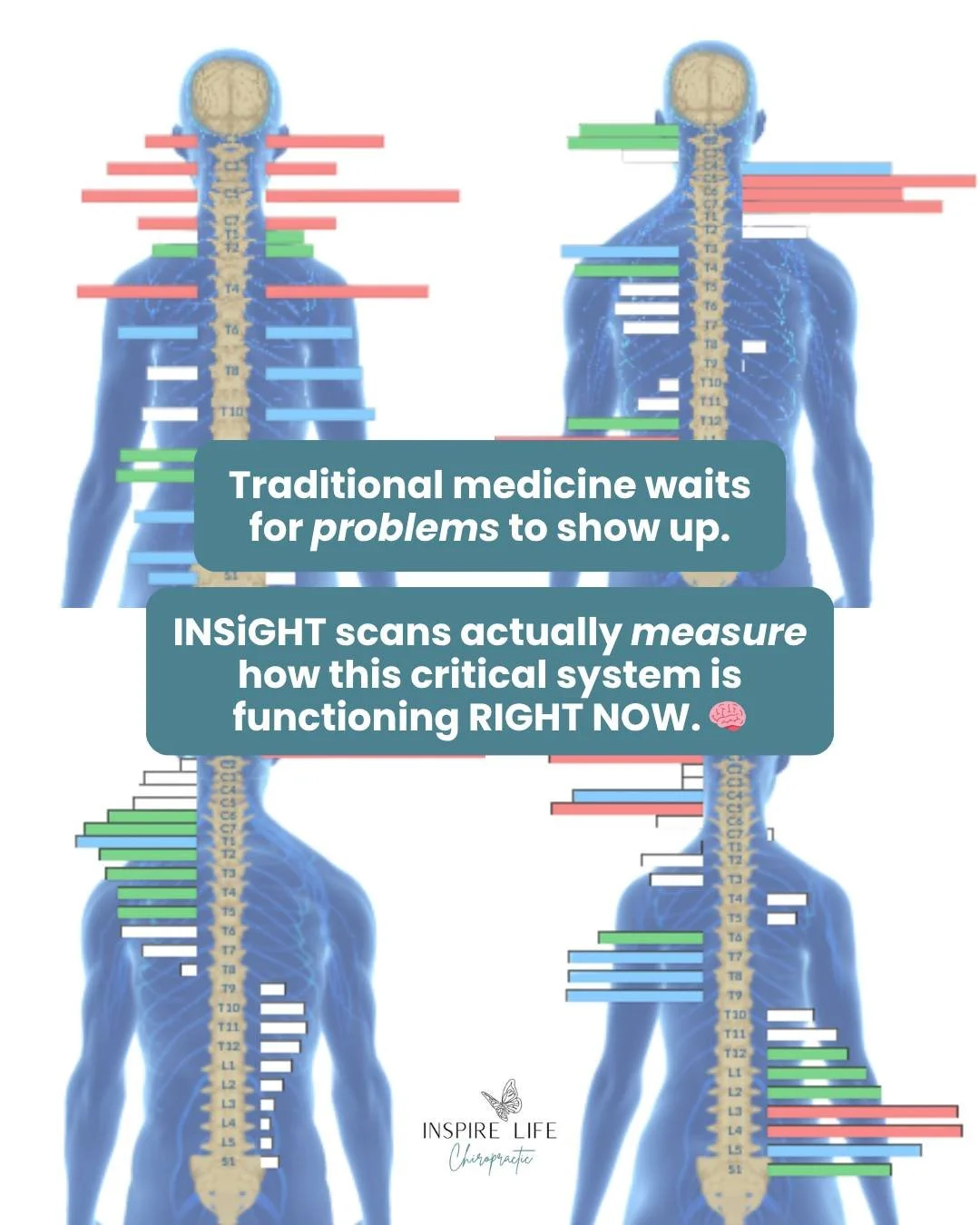 While your standard doctor chases symptoms and labels, they're completely missing what&rsquo;s going on in your nervous system. The air traffic controller that coordinates everything in your body.
Traditional medicine waits for problems to show up. I