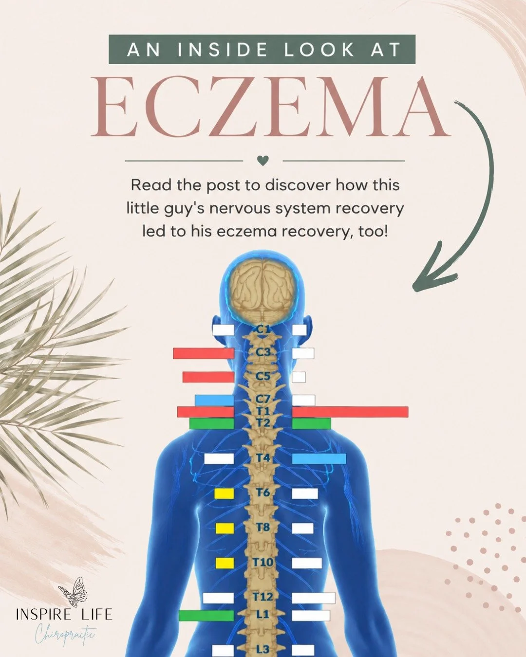 Eczema can be one of the most frustrating puzzles for parents.

You've changed the soaps, cleaned up the diet, added the probiotics, and tried the supplements. And while those things can absolutely help, many families still feel stuck searching for a