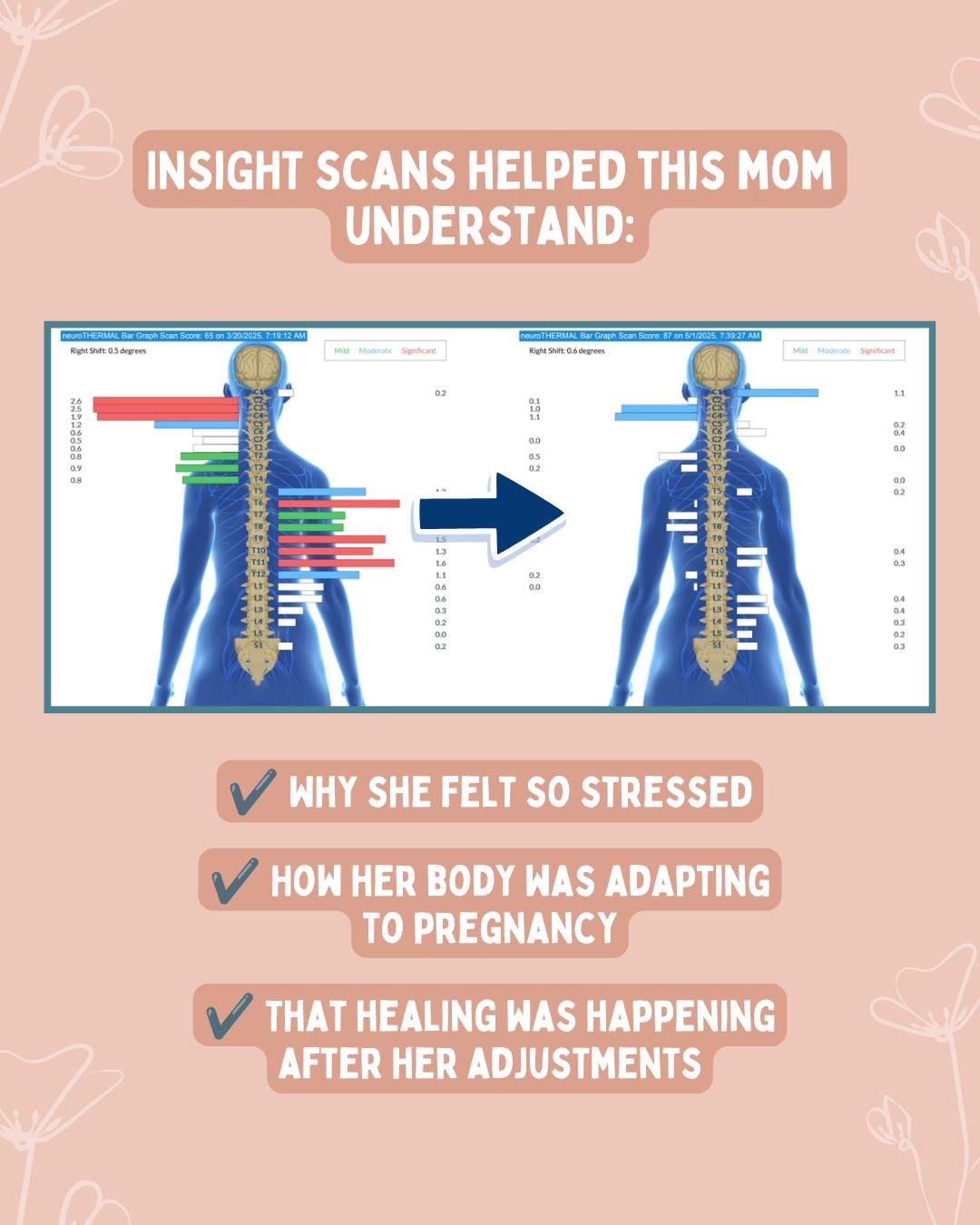 Bloodwork. Glucose tests. Ultrasounds.

They're all an important part of a healthy pregnancy. 🤍 But there's one system that often goes unchecked: your nervous system.

Your nervous system is helping your body adapt to every change pregnancy brings. 
