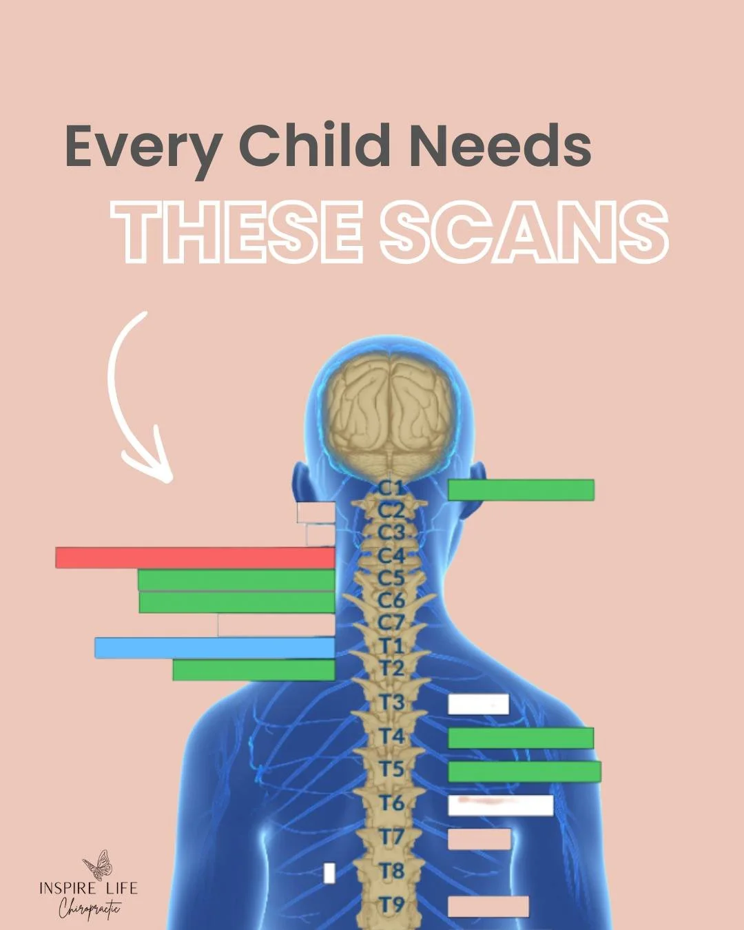 Schedule your family's scans today! Check out the link in our bio or call our office for more info! 🩵
 #nervoussystem #backtoschool #PediatricChiropractic