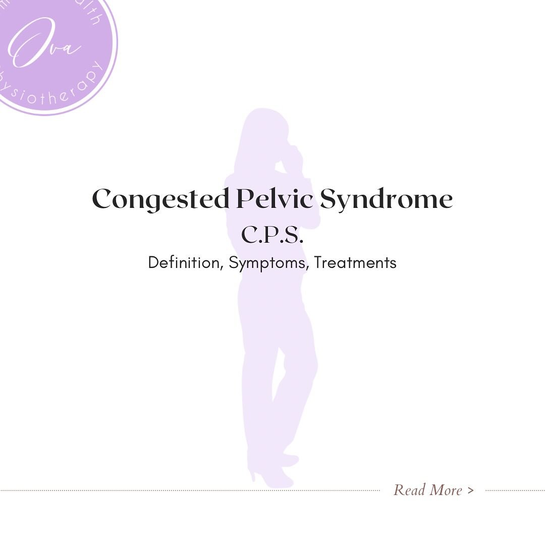 Congested Pelvic Syndrome (C.P.S.) is a complex condition that greatly affects quality of life. Pelvic Floor Physiotherapy is an effective, safe, holistic treatment option for C.P.S. It focuses on muscle rehabilitation, pain management, and lifestyle