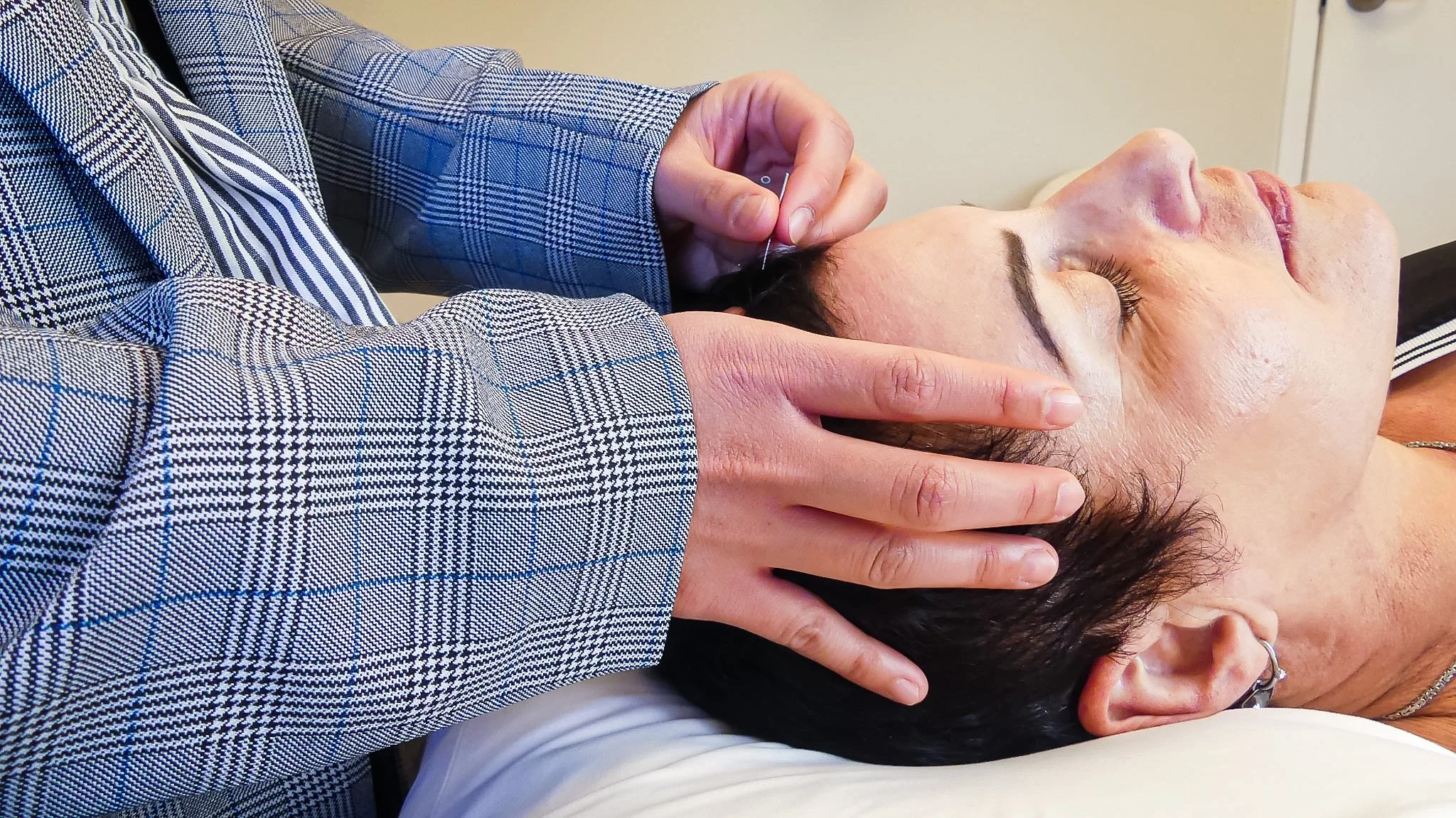 A person receiving an acupuncture treatment on their forehead while lying down, with an acupuncturist inserting a needle.