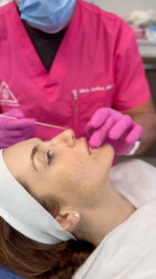 Lip Filler Vancouver