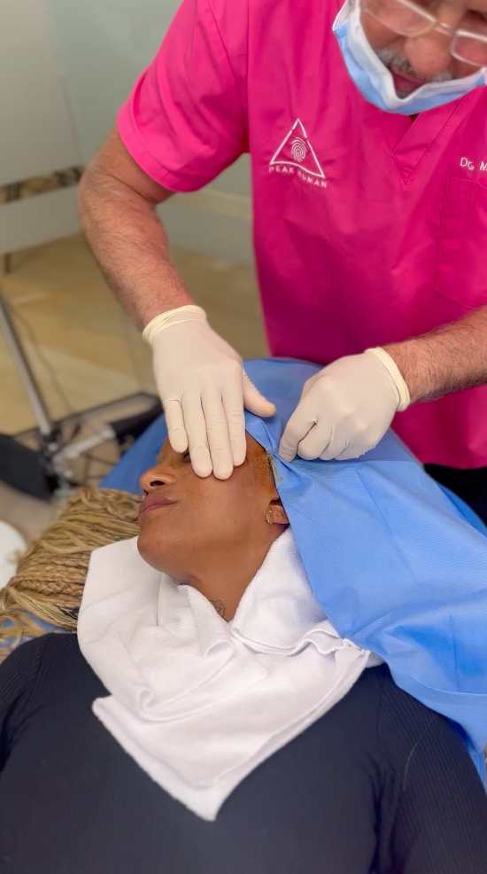 thread lift treatment with Dr. Godley in Vancouver