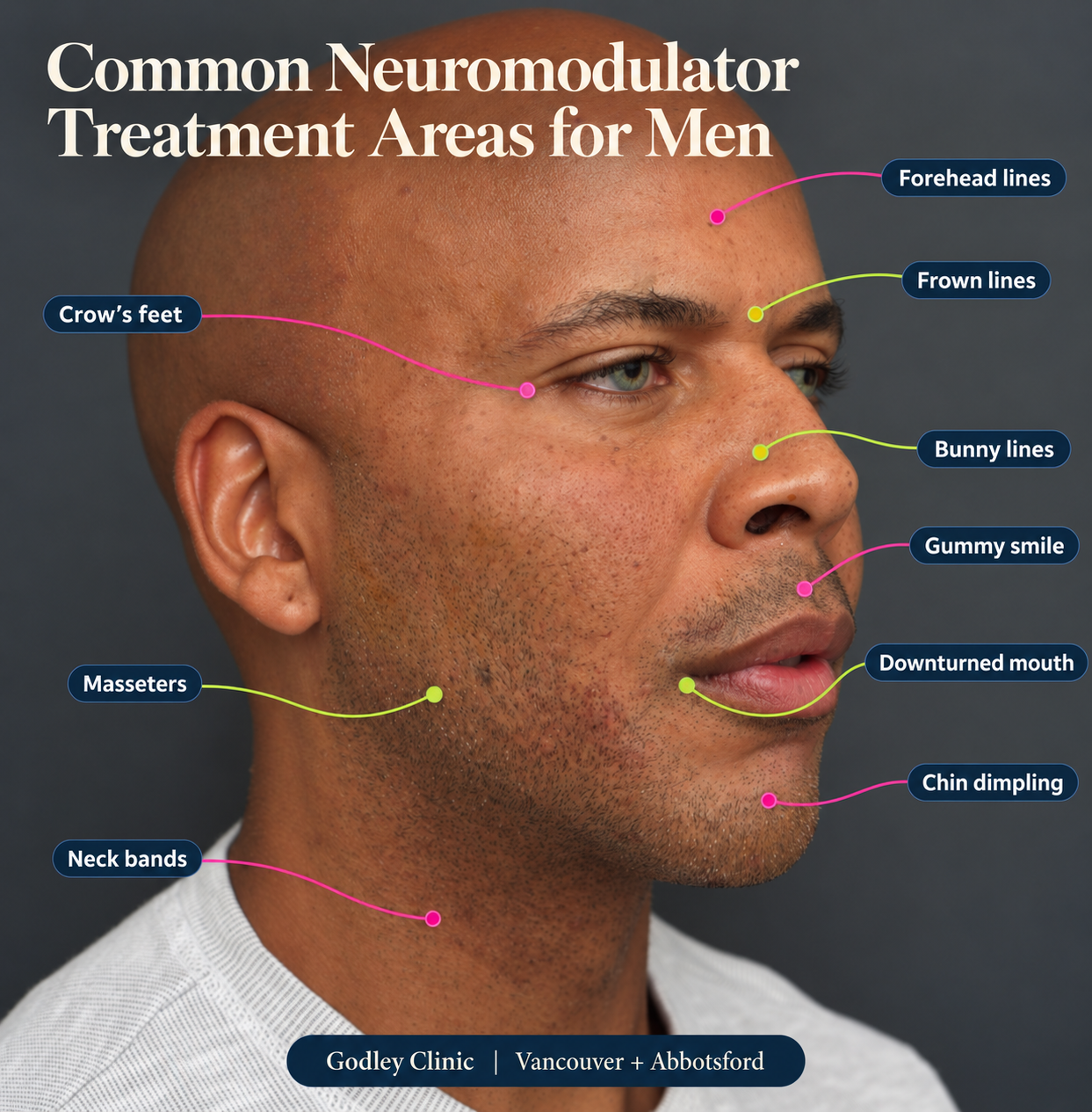 Botox for Men