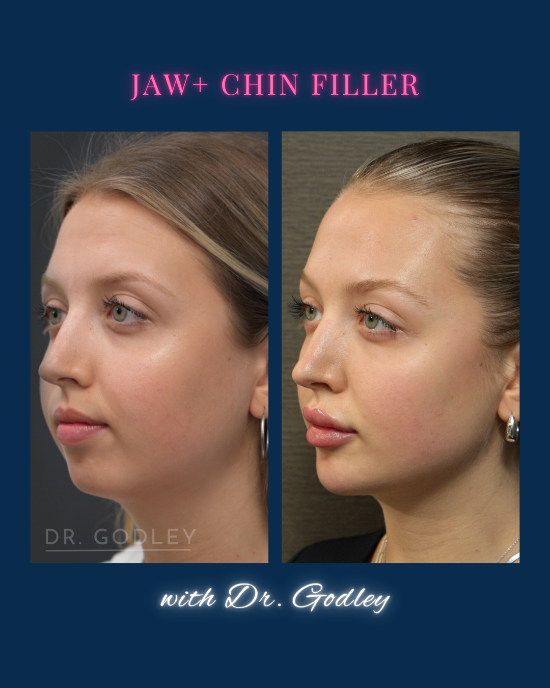 The Jawline: Dr. Godley on What He Uses, What He Avoids, and Why