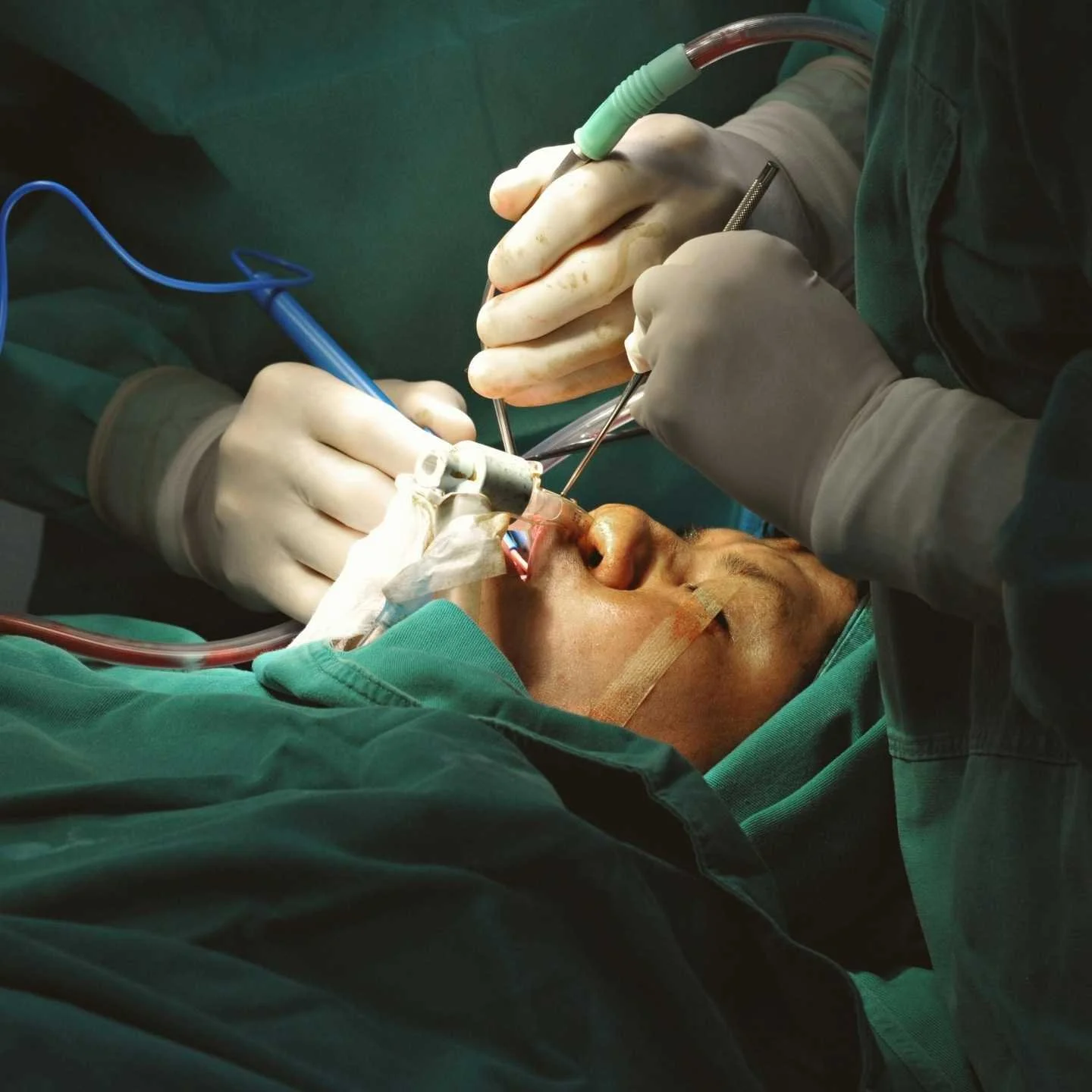 Face Lift Surgery - The image is a stock photo and is not an actual patient of Godley Clinic.