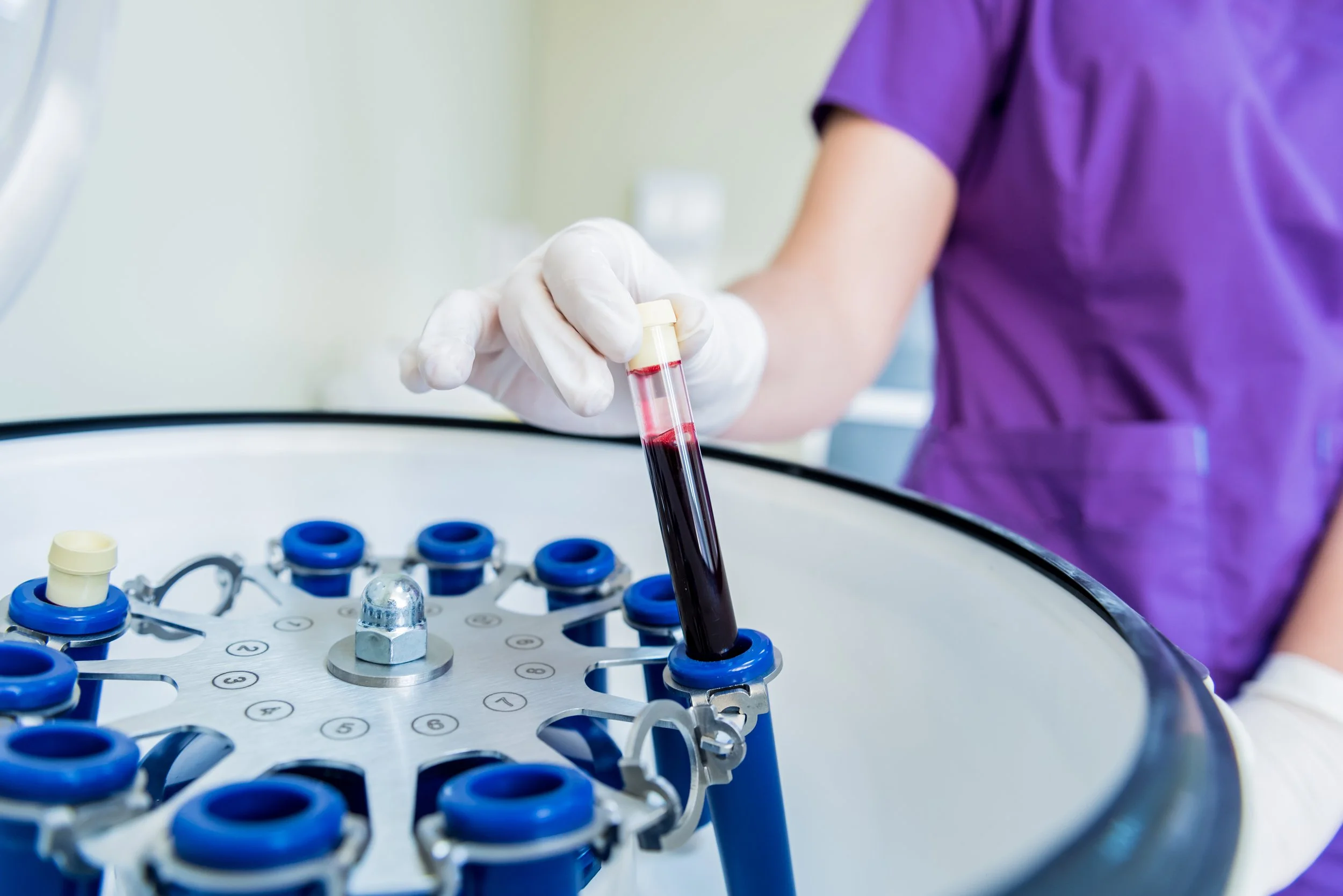 Everything You Need to Know About the P Shot: Procedure, Recovery, and Results