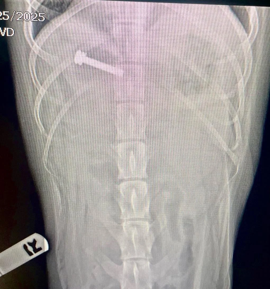 ๐ What’s That Wednesday? ๐
Take a look at this X-ray… ๐
Something unusual showed up inside this patient — can you spot it? Drop your guesses in the comments and we’ll reveal the answer later!
X-rays are an incredibly v