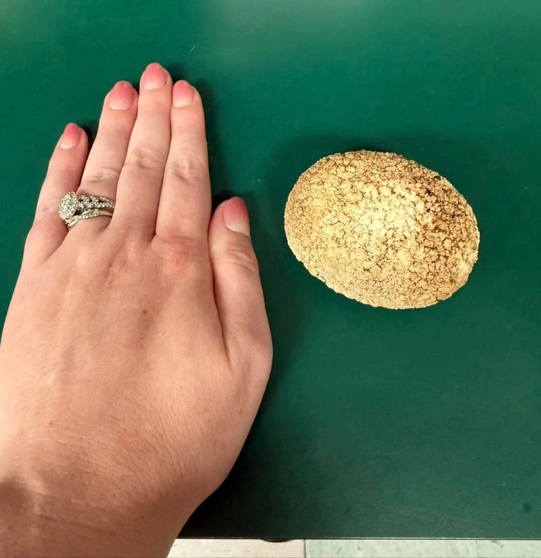 🔍 What’s That Wednesday?!
This might look like a rock, but it didn’t come from outside… 😬 It formed inside one of our patients and can cause some serious discomfort when it gets this big!
Here’s your hint: pets with these