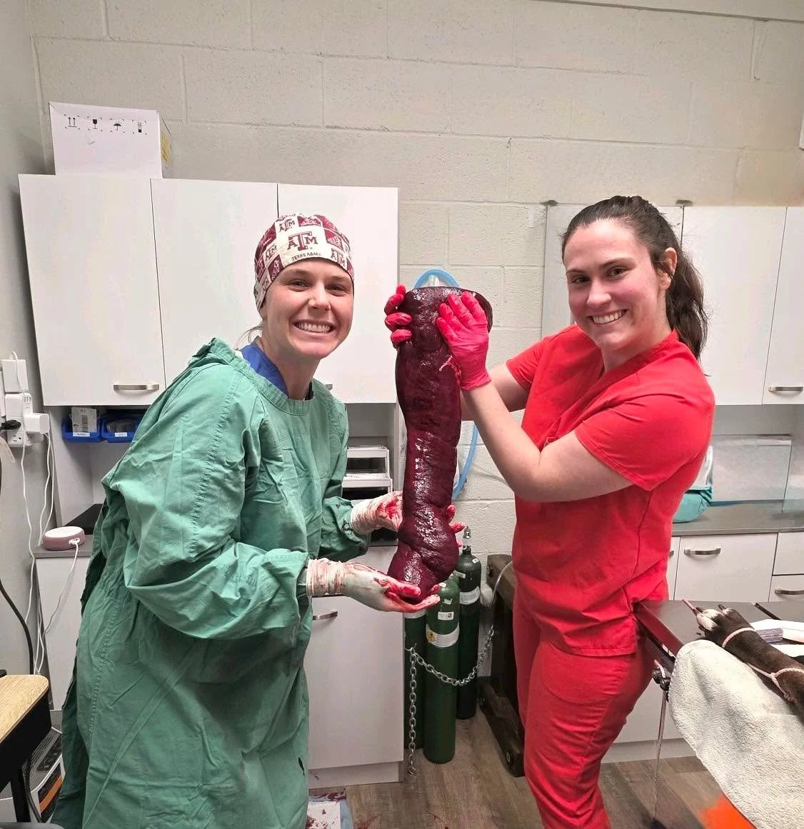 What&rsquo;s That Wednesday 👀

Dr. Eads and Dr. Stephens showing off something we removed from a patient this week&hellip; and WOW 😳

This is way bigger than it should ever be. Like&hellip; not even close to normal size.

A couple hints:
&bull; It 