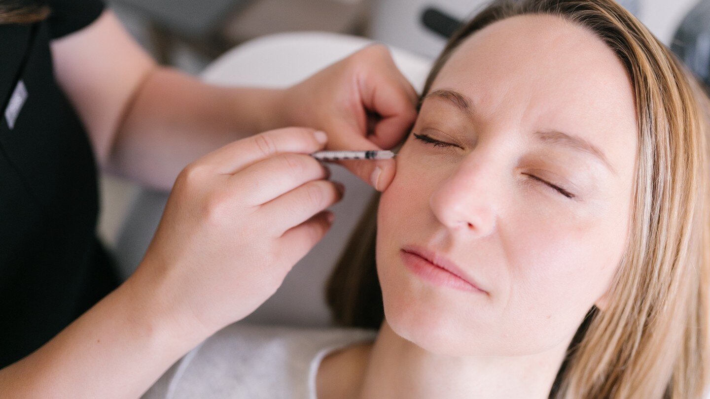 WHAT IS TOX? 🌿

NeuroTOXins are a type of medication that is injected into the muscle to weaken them and prevent muscle contraction. When the muscle no longer contracts, this prevents the skin from wrinkling and creating static lines. Over time, thi
