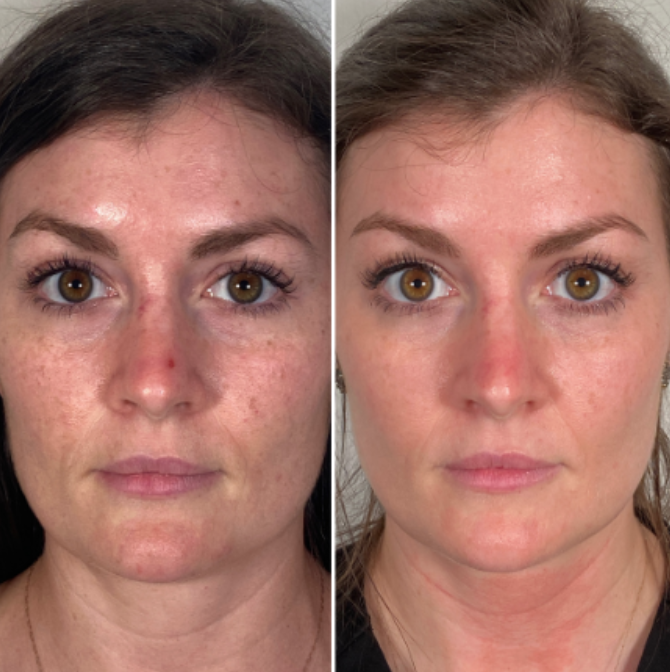 Screen Shot 2021-11-16 at 4.01.57 PM.png