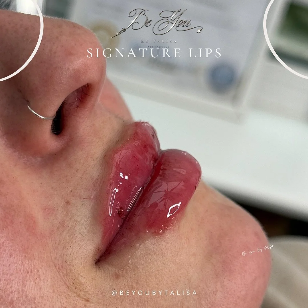 Who doesn&rsquo;t love a flat lip?? 

Treatment: Signature Lips 👄 

🔞Must be over 18yrs
💷 Non refundable deposit required to book
🏡 Home clinic/mobile appointments 
🚨 Emergency and complications Trained and cover areas 
🚑 Linked with a team of 