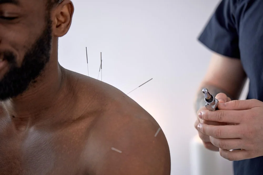 Expert Dry Needling in Arlington, VA