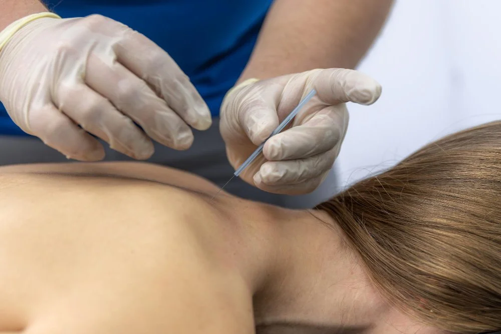 Conditions We Treat with Dry Needling & PT