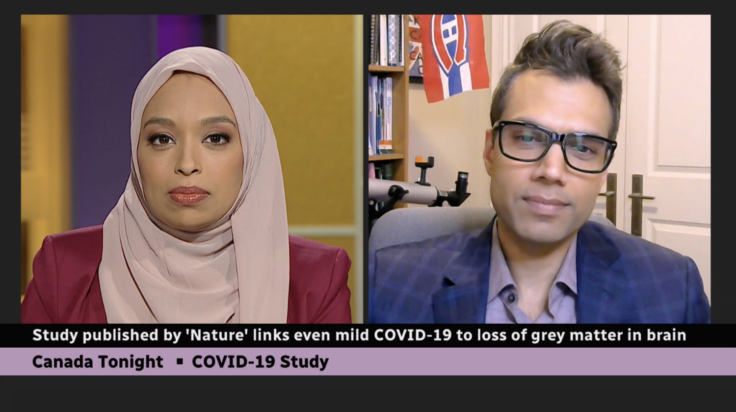 Study finds COVID-19 infection may cause changes in the brain