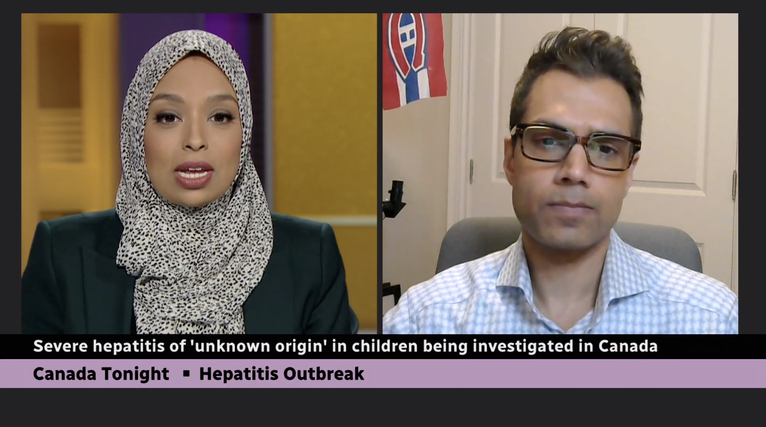 Public health officials are investigating severe hepatitis of 'unknown origin' in children
