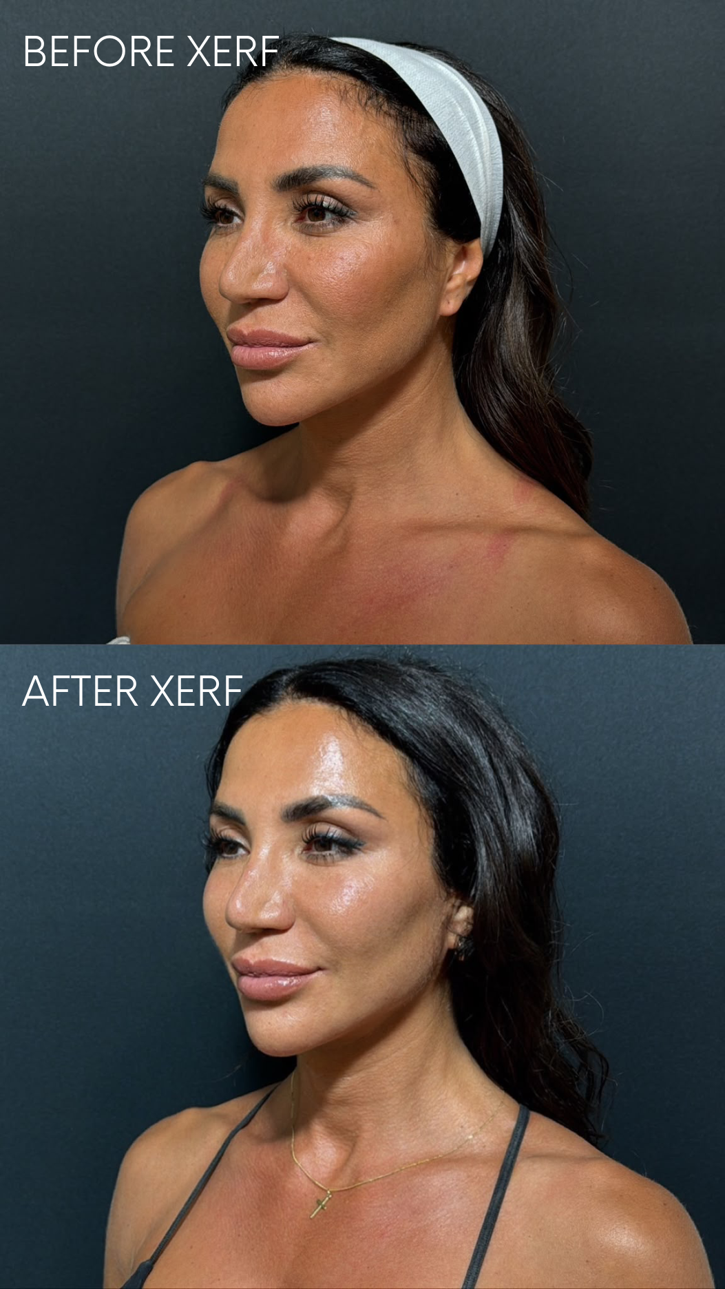 BEFORE AFTER XERF (2).png