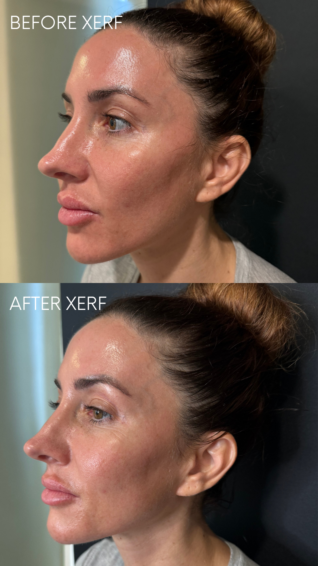 BEFORE AFTER XERF (4).png