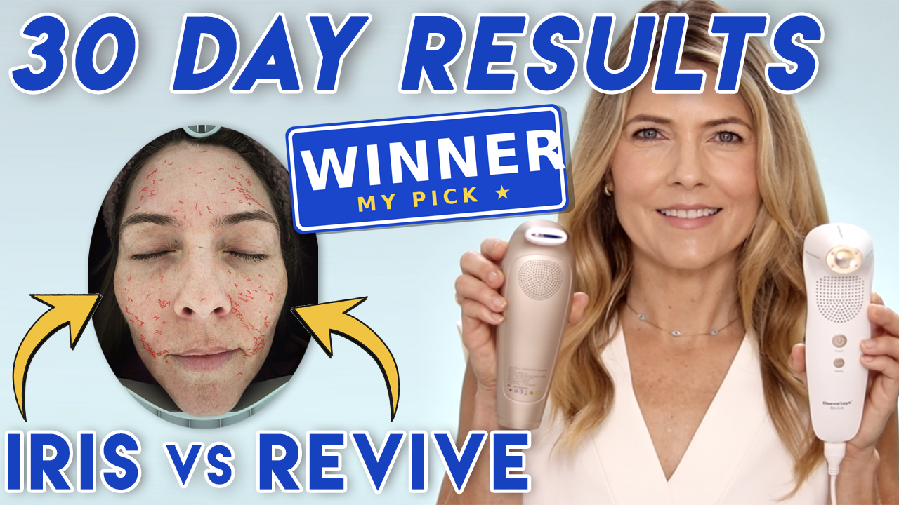 Iris Laser vs Revive Laser 30 Day Test Results