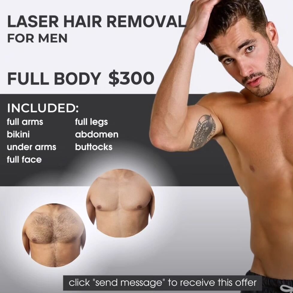 Full Body Laser Hair Removal $300 for 3 sessions! 
Can treat all skin types and tan skin. Call or text to book 602-784-4011. 

#men #menlaserhairremoval #phoenixarizona #menstyle #menselfcare #hairremoval #backhair #haircuts #waxing