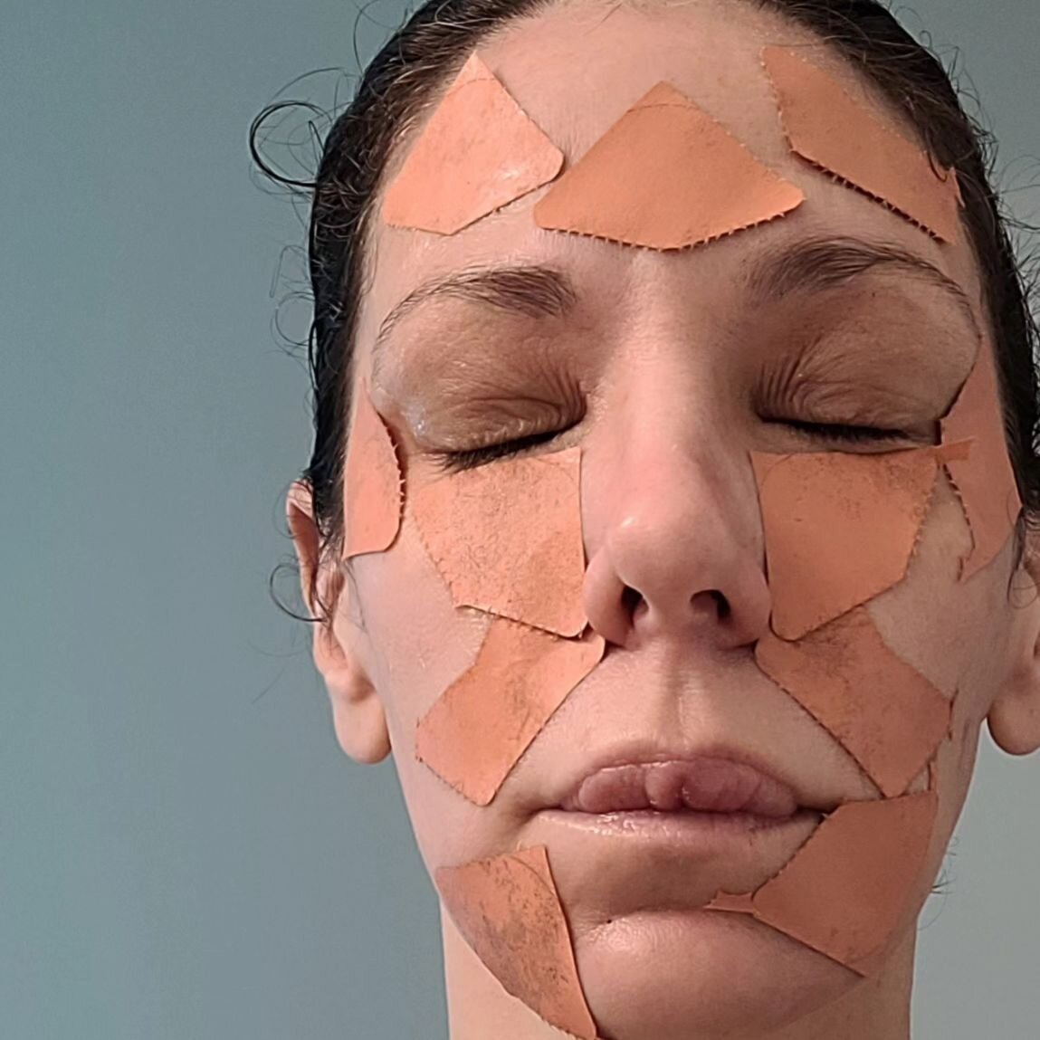 Face taping is an amazing tool to lessen the depth of wrinkles. At Laserboxx weemploy mny methods to build collagen and elastin to decrease wrinkles and fine lines if you are interested in face taping or how to achieve more collagen production withou
