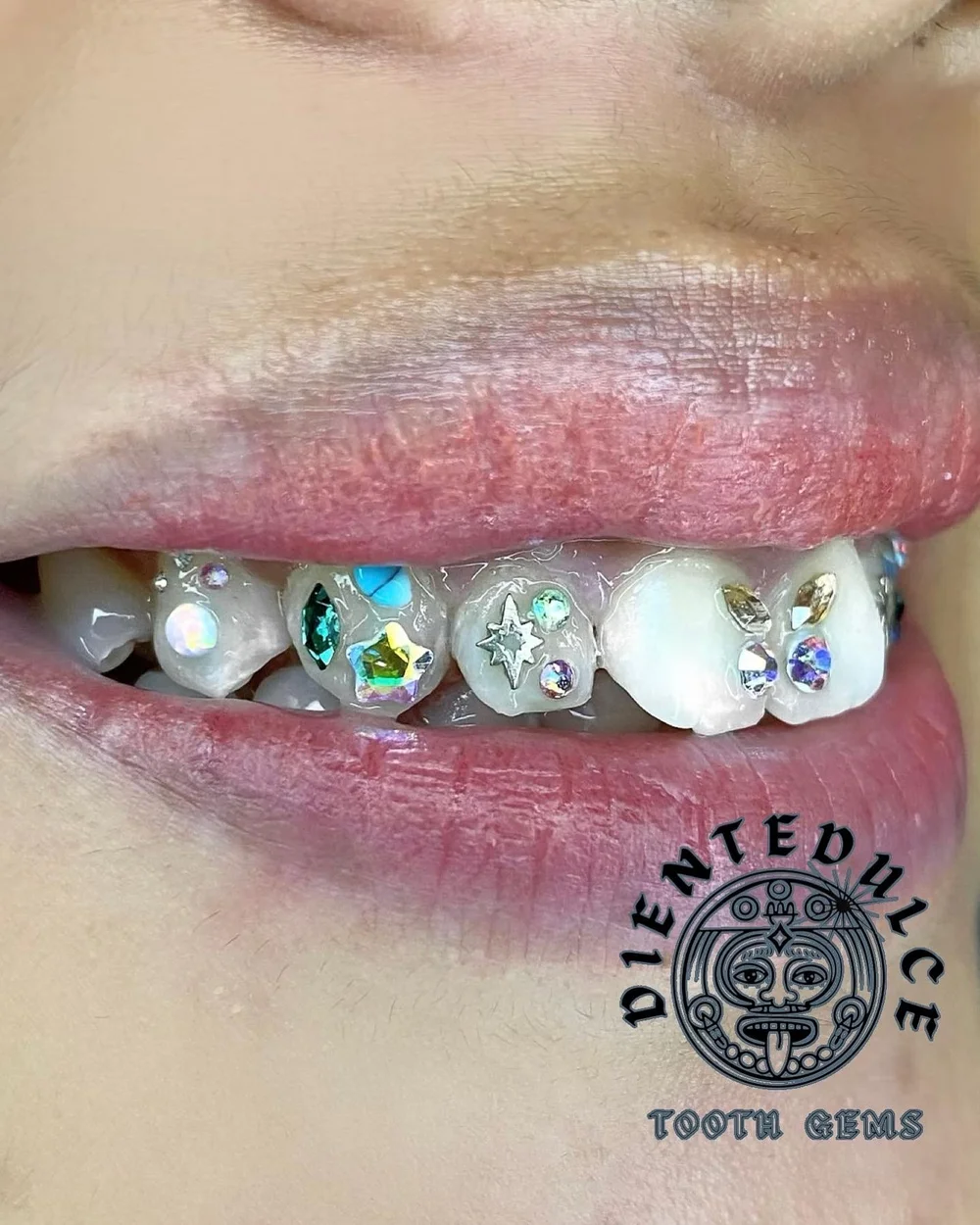 General 1 Diente Dulce Tooth Bling