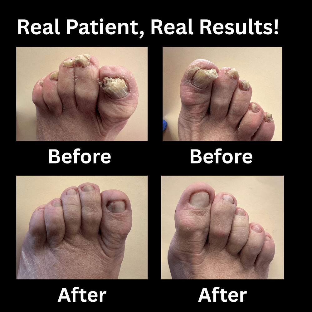 Concierge Podiatry & Spa, Before and after pics for Groupon — Concierge ...