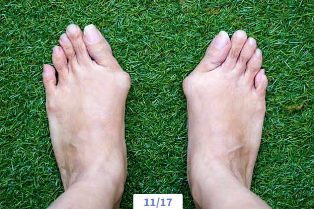 A pair of bare feet with slightly bent toes resting on green artificial grass.