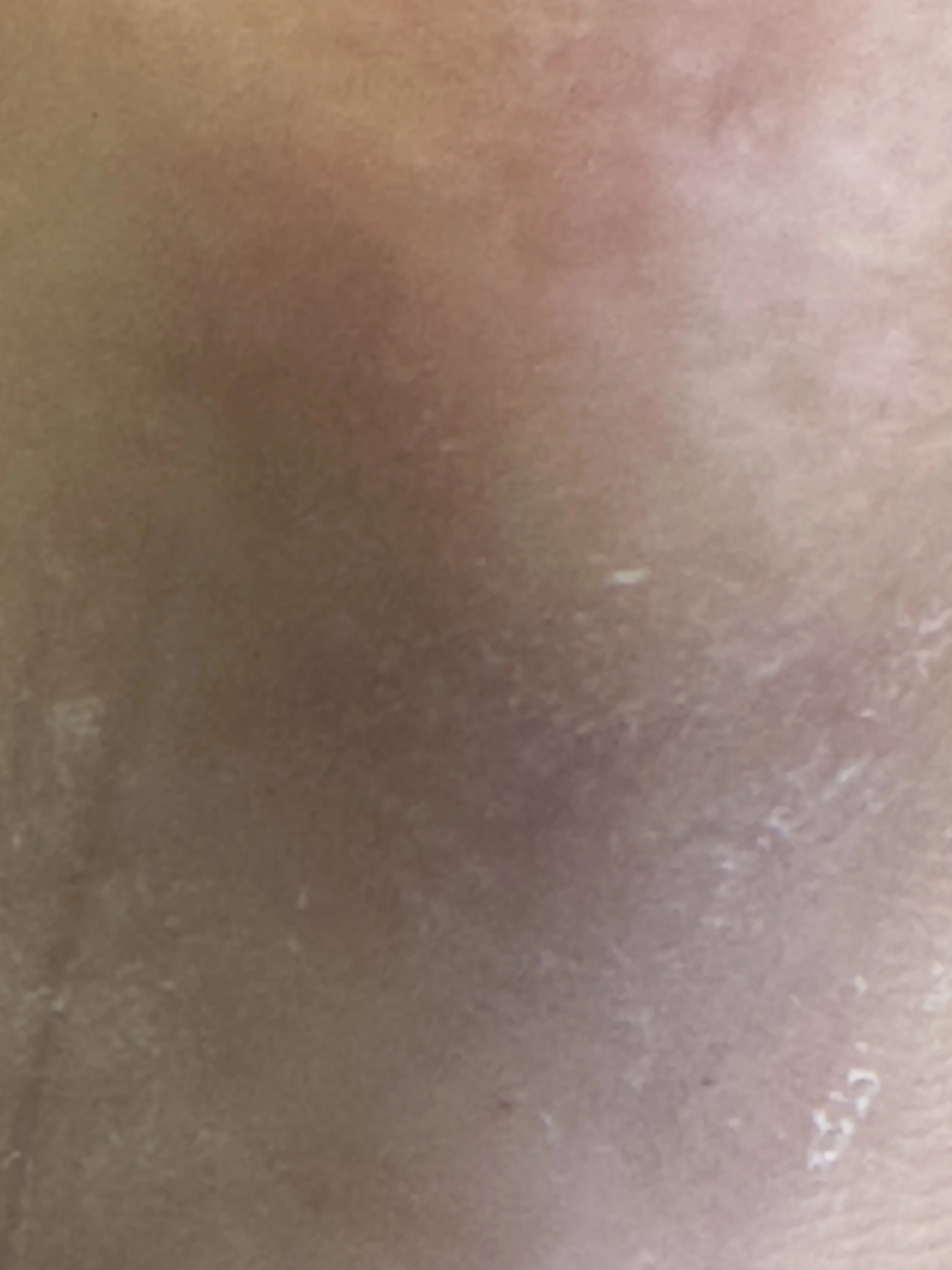 Close-up of human skin with visible pores and some minor imperfections.