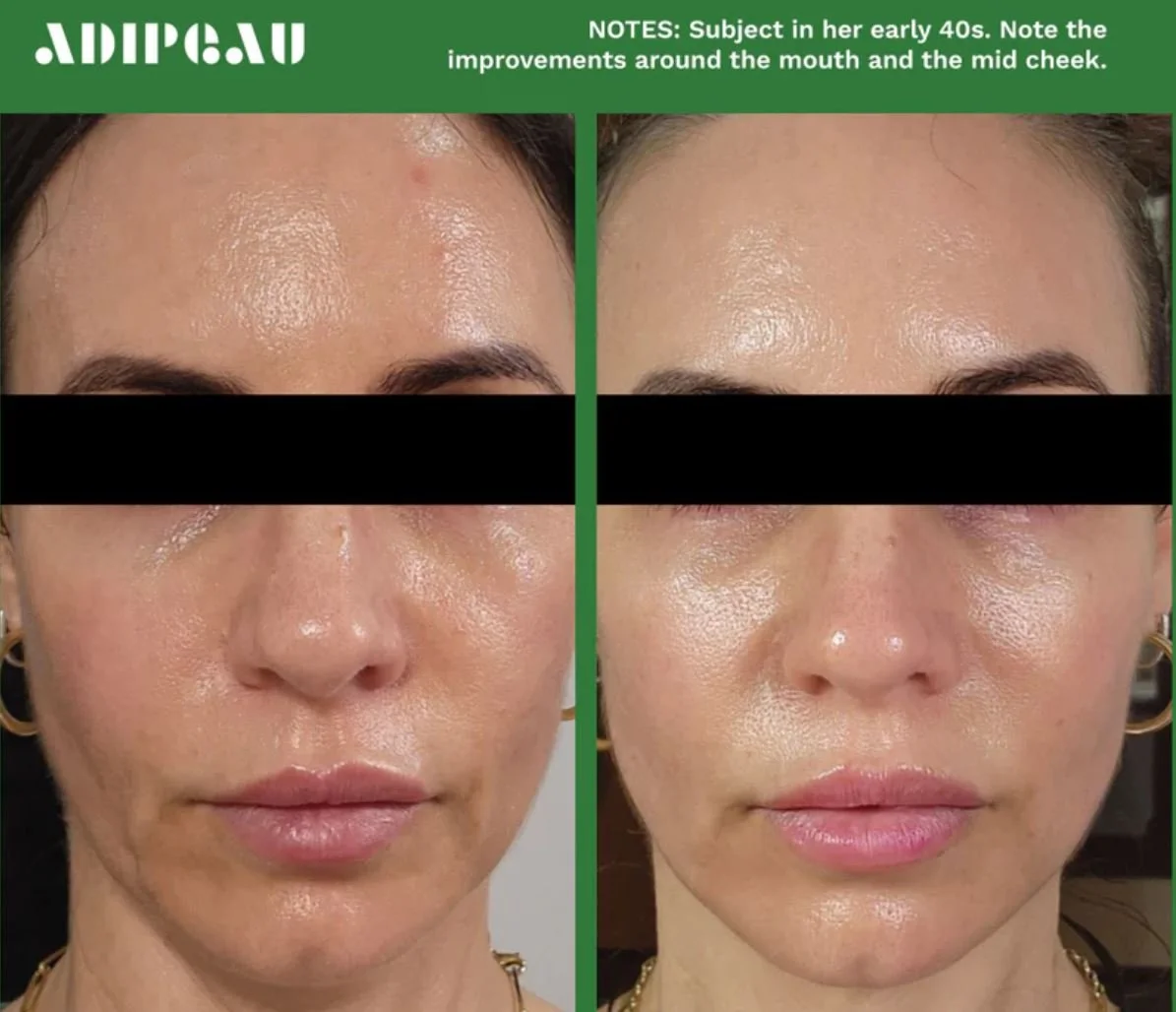 Adipeau_Volume_Cream_BeautyCare_Self_Care02.JPG