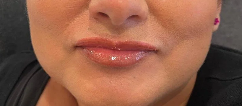 Close-up of a woman's lips with glossy pink lipstick and part of her nose and chin visible.