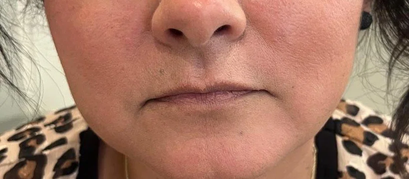 Close-up of a woman's face showing her nose and mouth, with a leopard-print top visible.