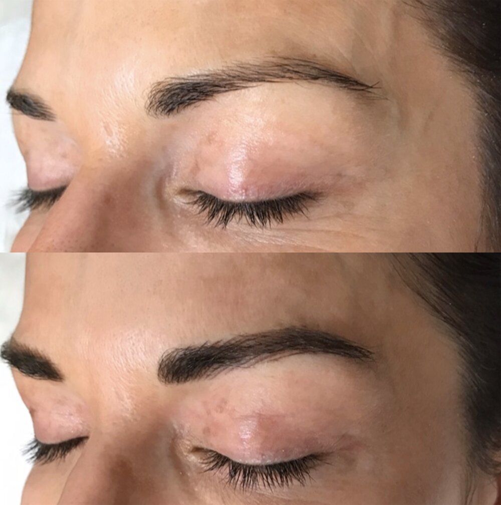 oni-skincare-microblading-technique.jpeg