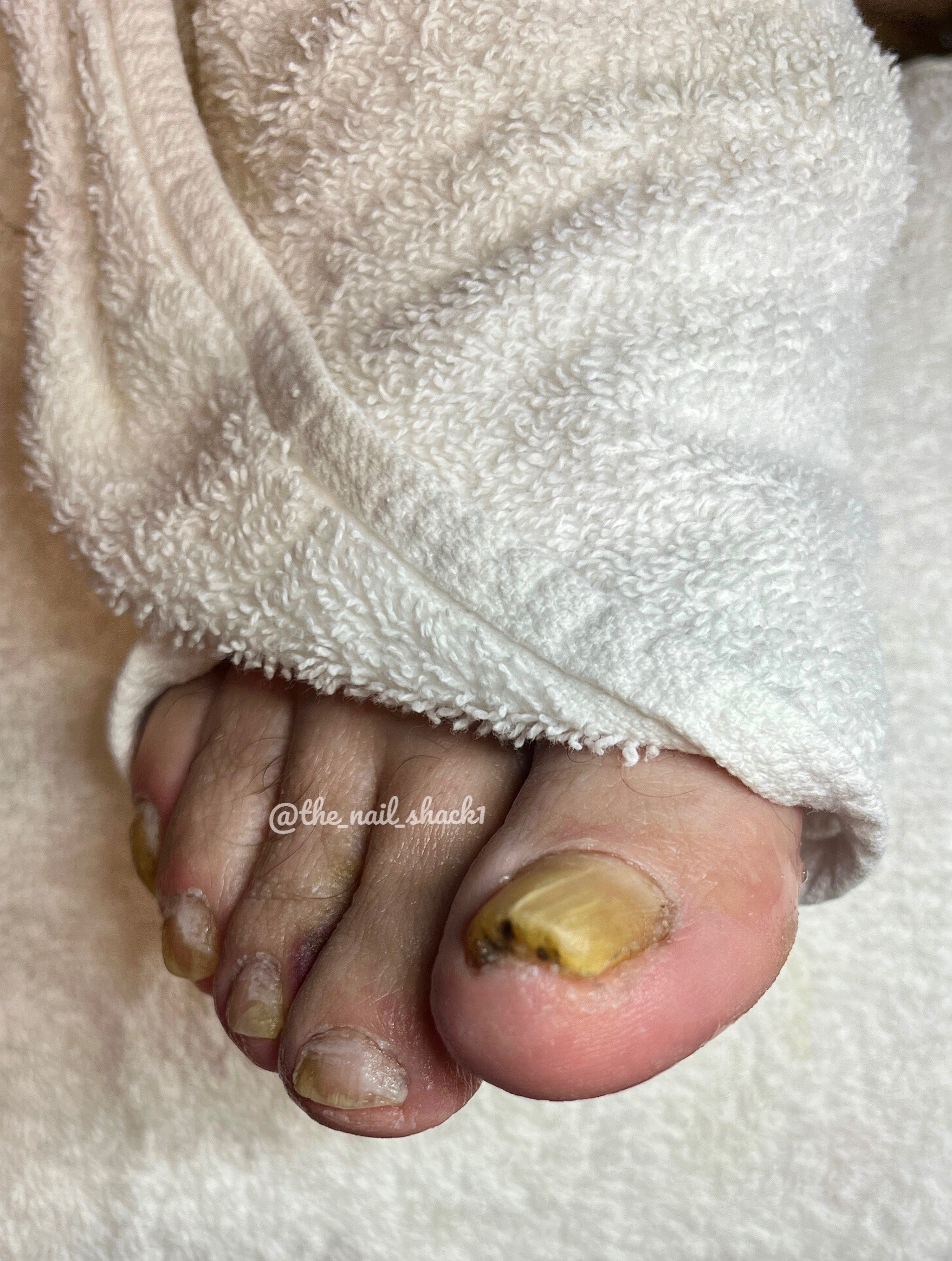 The part of your pedicure you don’t see